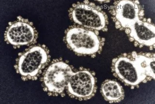 A Gyulladáscsökkentő Ételek Csodálatos Szerepe a Melanoma Helyreállításában – Természetes Támogatás a Gyógyuláshoz!