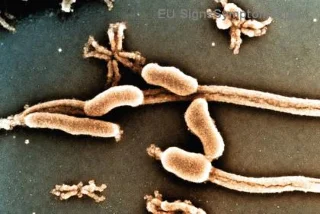 Je rakovina žalúdka v ranom štádiu vyliečiteľná? Pravda, ktorá mení všetko!