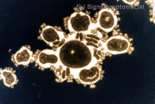 Gyógyítható-e a korai stádiumú melanoma? 99%-os esély a teljes gyógyulásra!