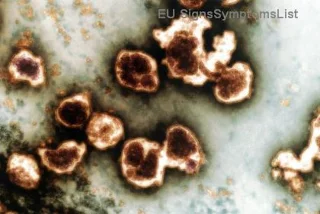 Je akutní myeloblastická leukémie (AML) u dospělých vyléčitelná? Naděje a skutečné možnosti léčby