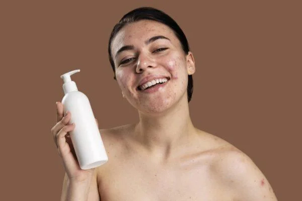 És bo esprémer l'acne?  Conseqüències greus quan esprem l'acne de la manera equivocada