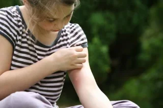 Barn bitna av insekter: Hur ska föräldrar hantera?