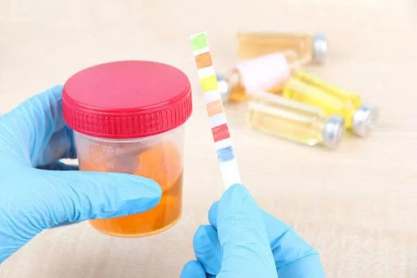 Que é a obstrución ureteral e como che molesta?