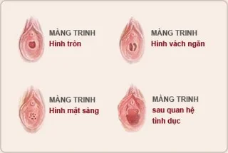 La vulva en la dona: un òrgan "sensible".