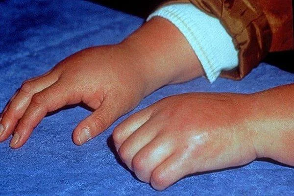 Simpatinė nervų sistema: struktūra ir funkcijos