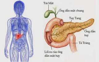 Tumores pancreáticos endócrinos: cancro perigoso e o que debes saber