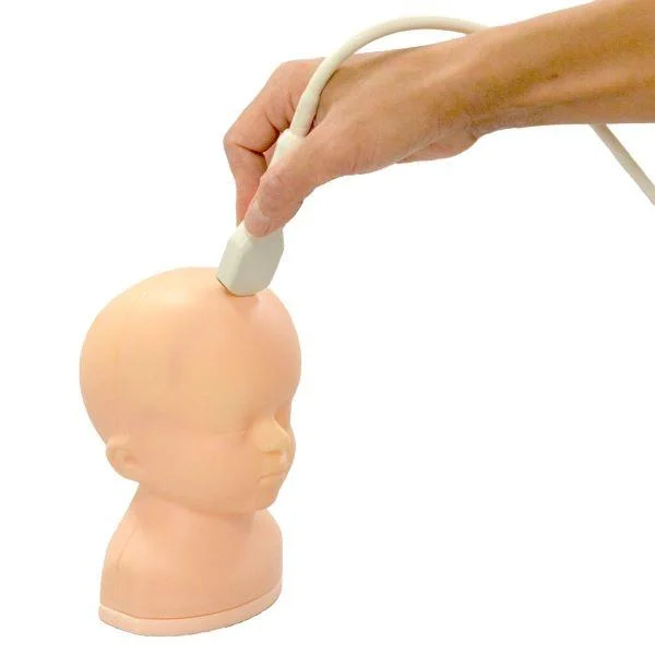 Konvensjonell medisin: Hydrocephalus