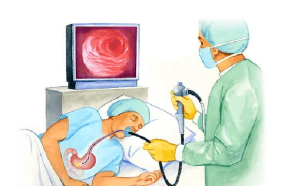 Hvad du behøver at vide om eosinofil esophagitis