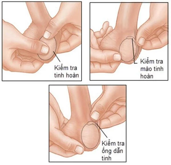 Hver er eðlileg stærð eista?
