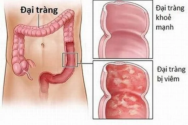 Quina és l'estructura i funció del còlon humà?