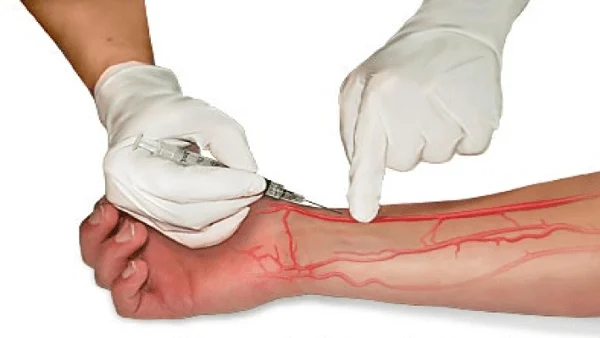 Síndrome hepatopulmonar: definició, signes, diagnòstic i tractament
