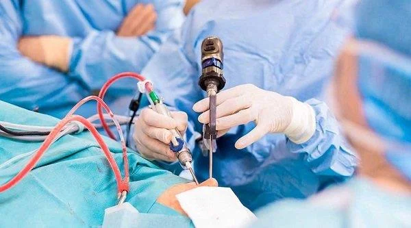Rinoplastia: todo o que debes saber