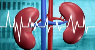 Estenosi de lartèria renal: manifestacions, diagnòstic i tractament