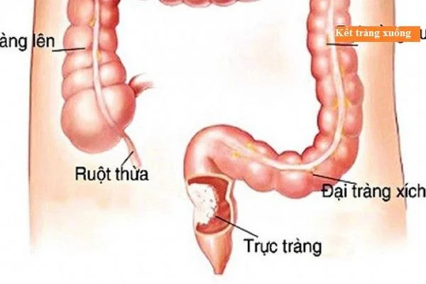 Quina és l'estructura i funció del còlon humà?