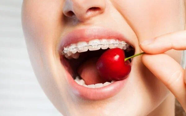 Que comen as persoas con brackets e que non deben comer?