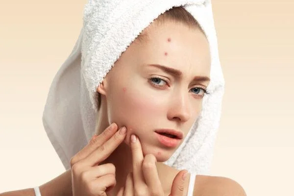 És bo esprémer l'acne?  Conseqüències greus quan esprem l'acne de la manera equivocada