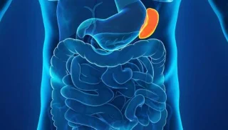 Primær myelofibrose: Sådan genkendes, overvåges og behandles