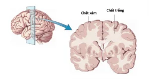 Demencia vascular: causas, síntomas e tratamento