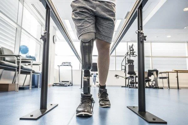 Fantomlemmersmerter: Årsager, diagnose og behandling