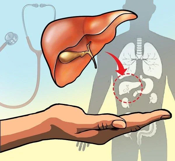 Síndrome hepatopulmonar: definició, signes, diagnòstic i tractament
