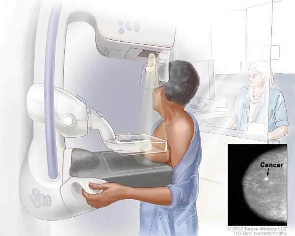 BRCA genið og hættan á brjóstakrabbameini og öðrum líffærakrabbameinum