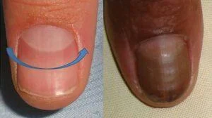 Que che indica o semicírculo da túa unha?
