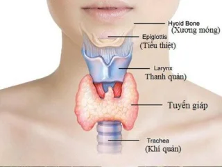 Hipertiroidismo: causas, síntomas e tratamento
