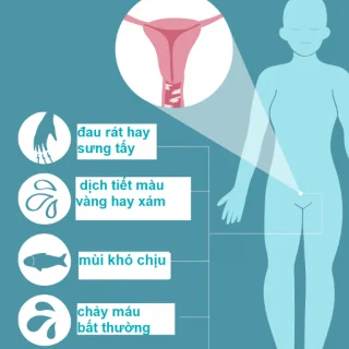 Vaginitis: Vse, kar morate vedeti