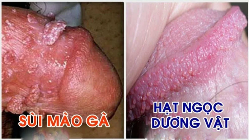 Haigused, mida on lihtne tüügastega segi ajada, peaksite teadma