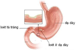 Kur yra epigastrium?  Kodėl tai svarbu?