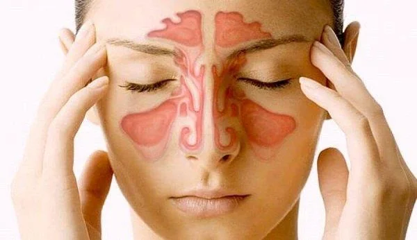 Rinoplastia: todo o que debes saber