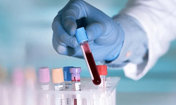 O que debes saber sobre a flebite