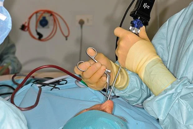Pólipos nasais: cales son os tratamentos?  Cando necesito unha cirurxía?