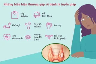 Hipertireoze un tās ietekme uz jūsu ķermeni?