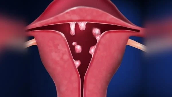 Menstruacija 2-krat v 1 mesecu je nenormalna ali normalna?