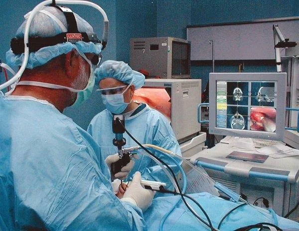 Rinoplastia: todo o que debes saber