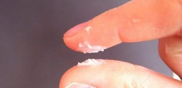 Ali je vaginitis noseča in odgovor zdravnika