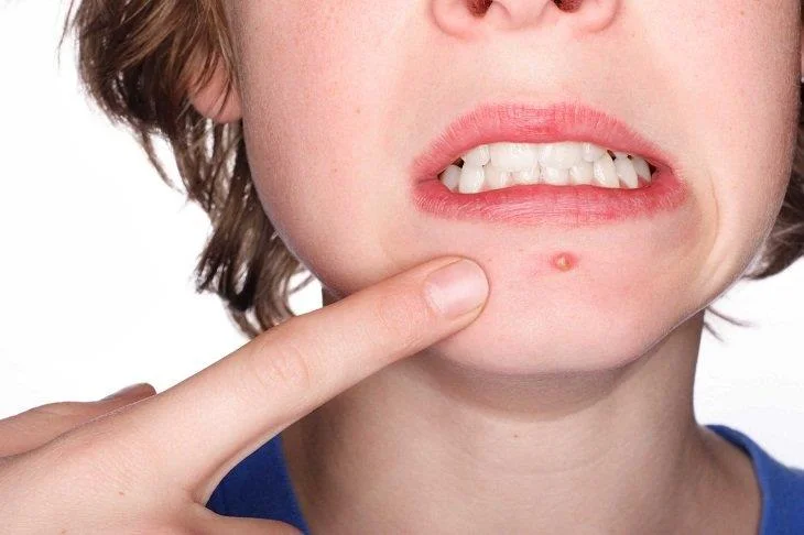 8 märki, mis aitavad teil menstruatsiooni 1 nädal ette ennustada