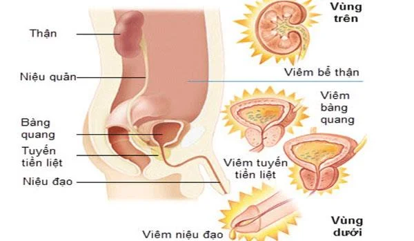 Pange tähele, kui kasutate ravimeid meeste uretriidi raviks