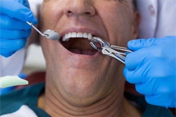 Com tenir cura després de l'extracció de la dent per curar-se bé?