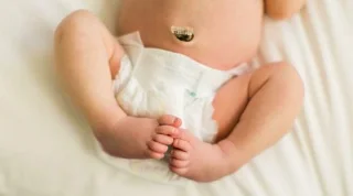Cordón umbilical recentemente nado: problemas relacionados