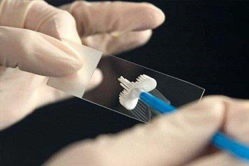 Hvordan teste for HPV hos menn?