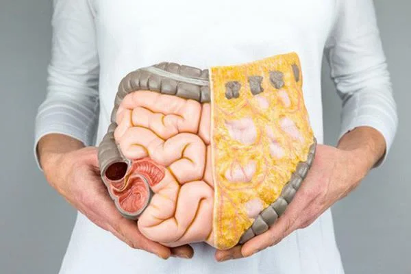 Það sem þú þarft að vita um BMI