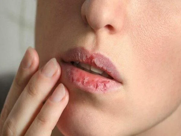 Alarma canto é perigoso o nivel de azucre no sangue mediante o consello do médico