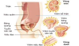 Tingueu en compte quan utilitzeu medicaments per tractar la uretritis en homes