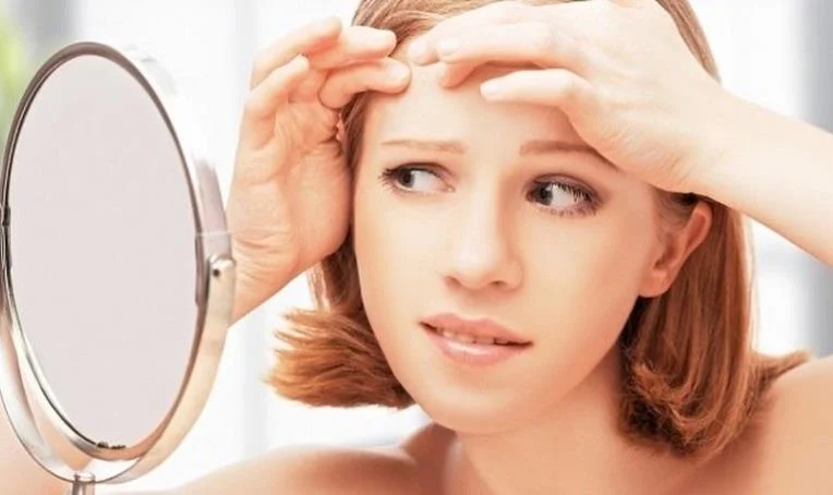 Coñeces estes 13 malos hábitos que causan acne?