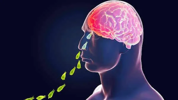 Er Naegleria amoeba-infektion farlig?