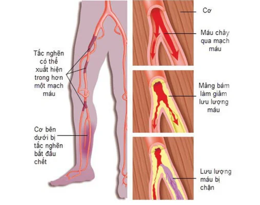 Arterias: vasos sanguíneos que levan nutrientes ao corpo